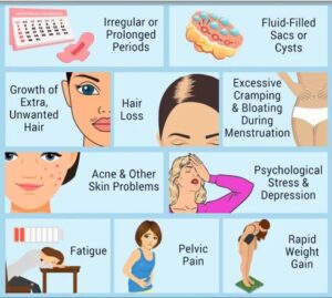 Herbal decoction for pcod & pcos uses and benefits